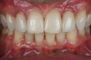 prosthodontist edmonton Dental Design Concepts - Dr. Cornell Lee