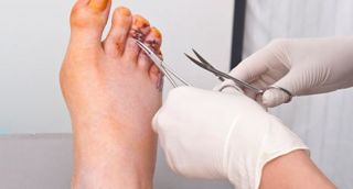 foot care edmonton Step Ahead Podiatry Clinic