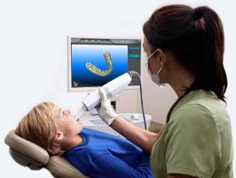 Digital Intra-Oral scan to make a 3D model of your mouth