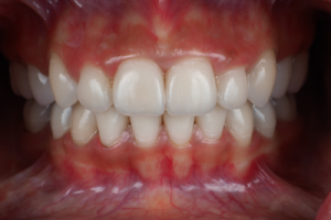 cosmetic dentist edmonton Dental Design Concepts - Dr. Cornell Lee