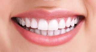 teeth whitening service edmonton Downtown Core Dental